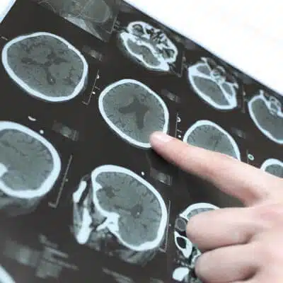 Peptides for Alzheimers Disease Research