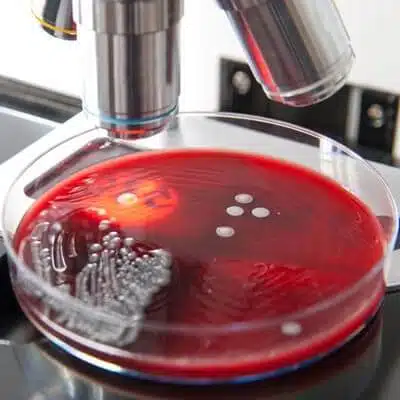 Antimicrobial Peptide (AMP) Research